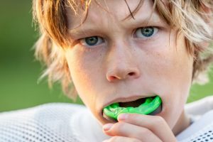 Protecting your Smile with Sports Guards